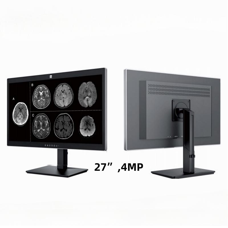 27인치 4MP 의료 진단 디스플레이