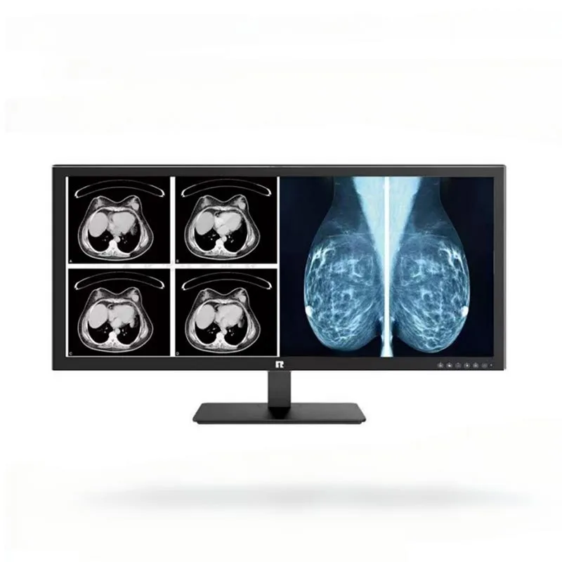 34-inch 5MP Medical Diagnostic Monitor