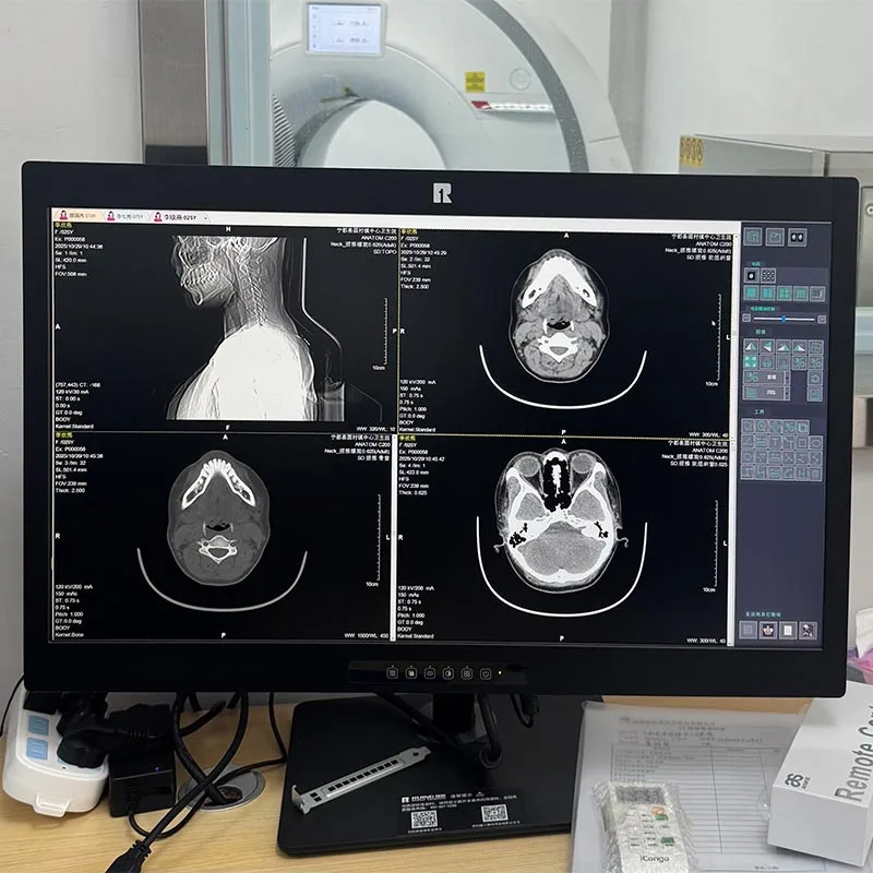 34-inch 5MP Medical Diagnostic Monitor