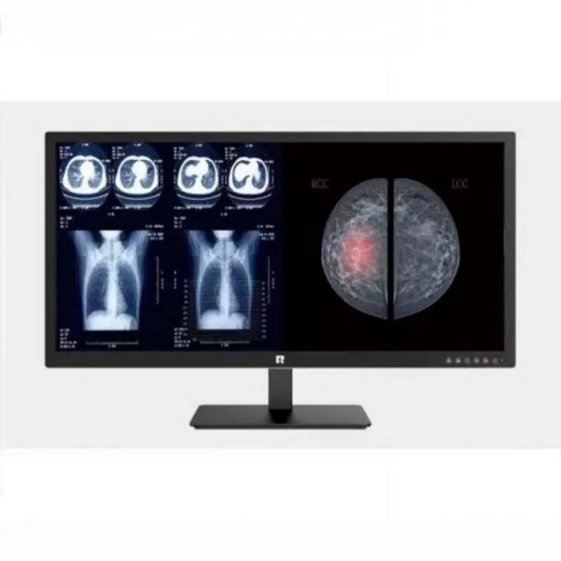 34-inch 5MP Medical Diagnostic Monitor