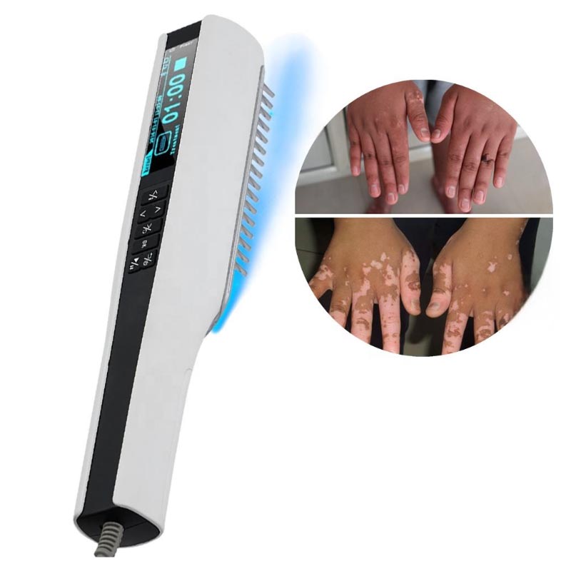 자외선 광선치료기